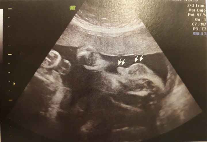 Futuras mamas octubre 2020 - 1