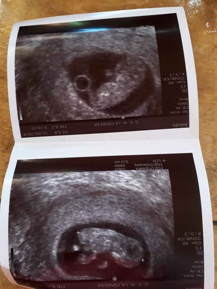 hola!!!! me gustaría que me dieras tu opinión que te parece niño o niña  es una eco vaginal echa a l