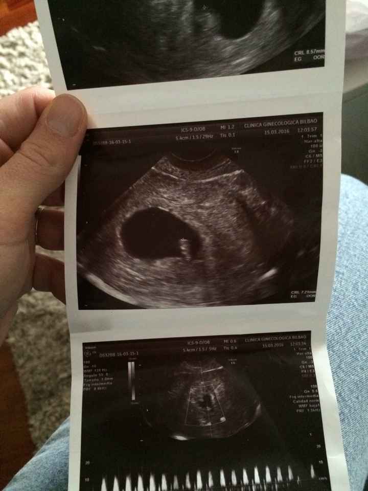 ¡futuras mamis noviembre 2016! - 1