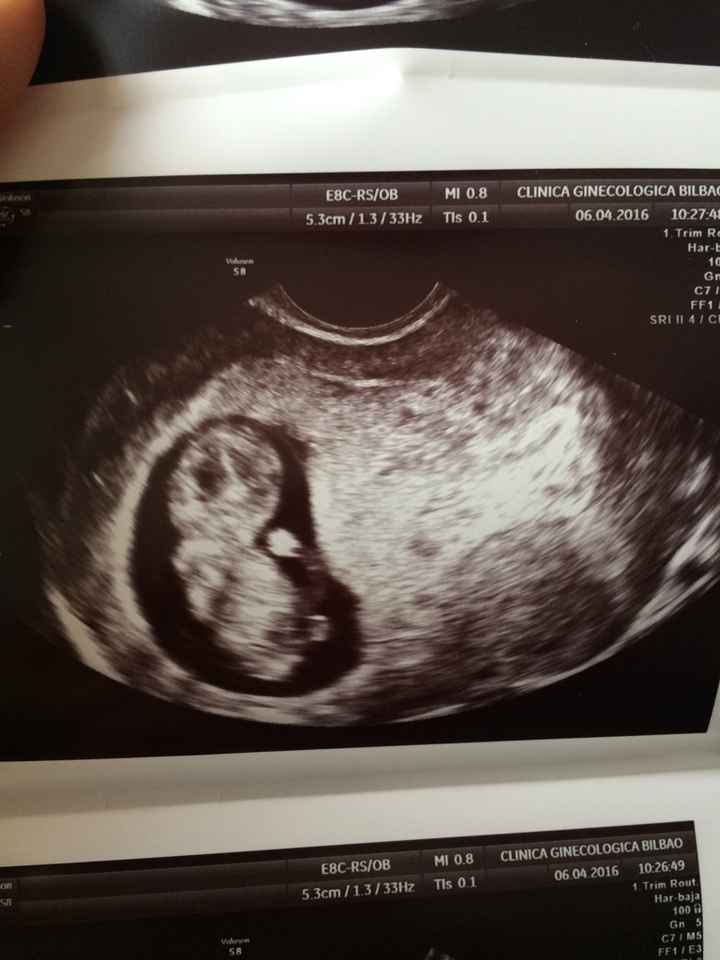 ¡futuras mamis noviembre 2016! - 1