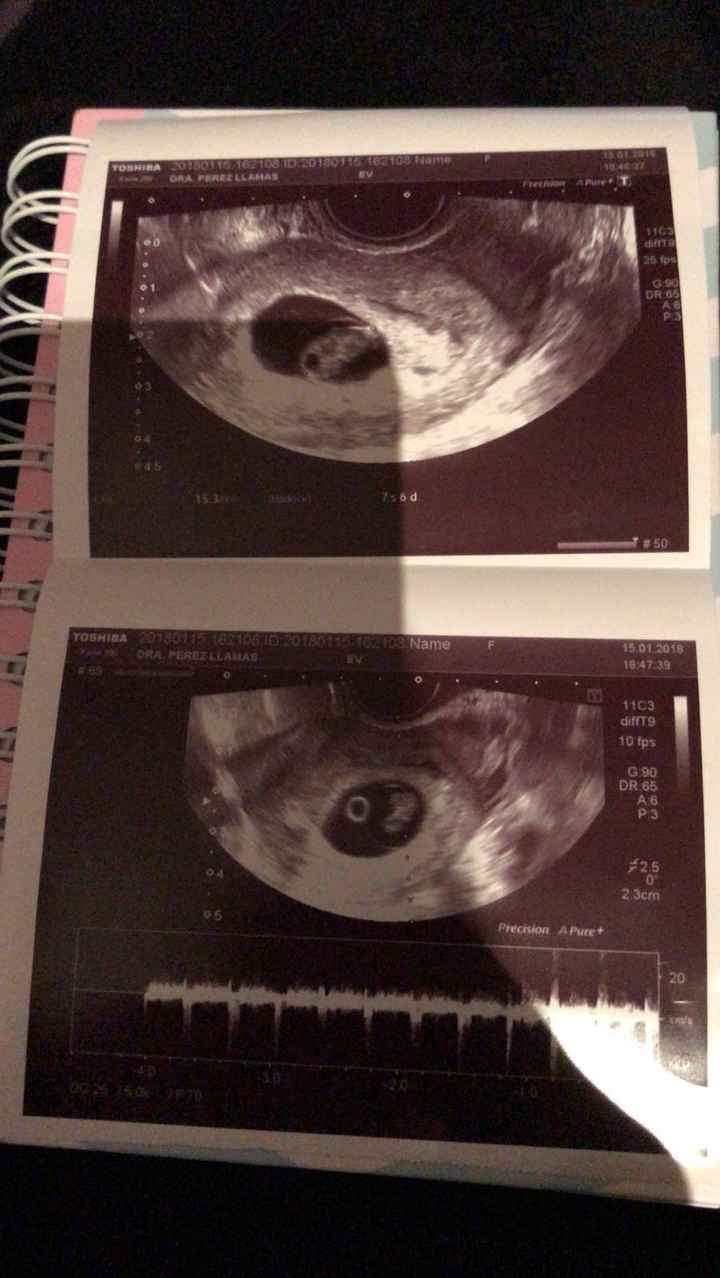 hola me gustaría que me dieras tu opinión que te parece niño o niña  