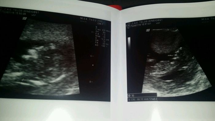 Mamis enero 2016 - 1