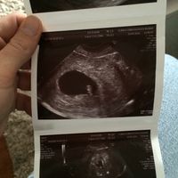 ¡futuras mamis noviembre 2016! - 1