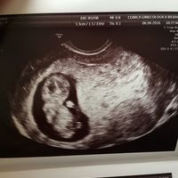 ¡futuras mamis noviembre 2016! - 1