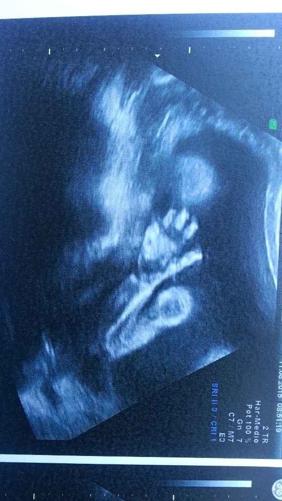 La manita de mi princesa