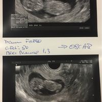 Futuras mamis enero 2018 - 1