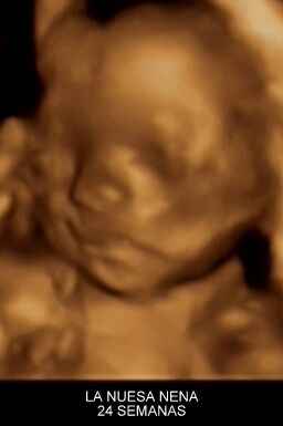 24 semanas