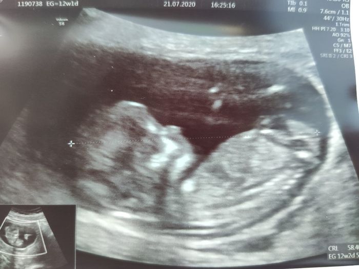 Futuras mamis Febrero 2021 - 1