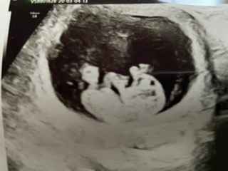 Futuras mamas octubre 2020 - 1