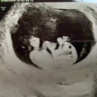 Futuras mamas octubre 2020 - 1