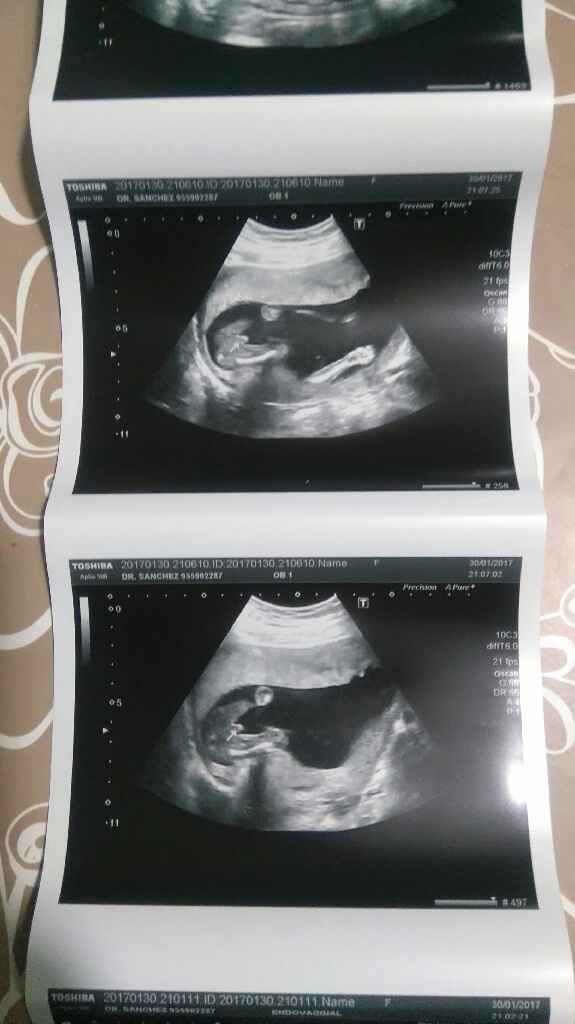 Mamis julio 2017 - 2