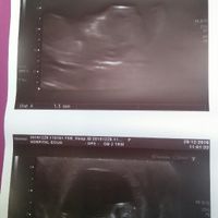 Mamis julio 2017 - 1