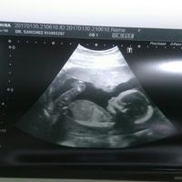 Mamis julio 2017 - 1