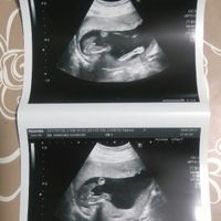 Mamis julio 2017 - 2
