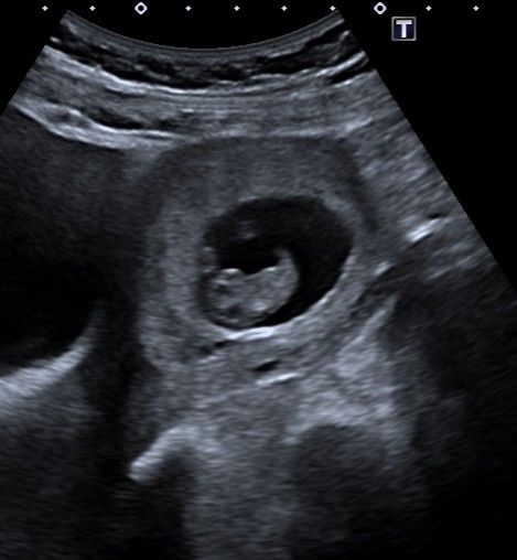 Futuras Mamis Enero 2021 - 1