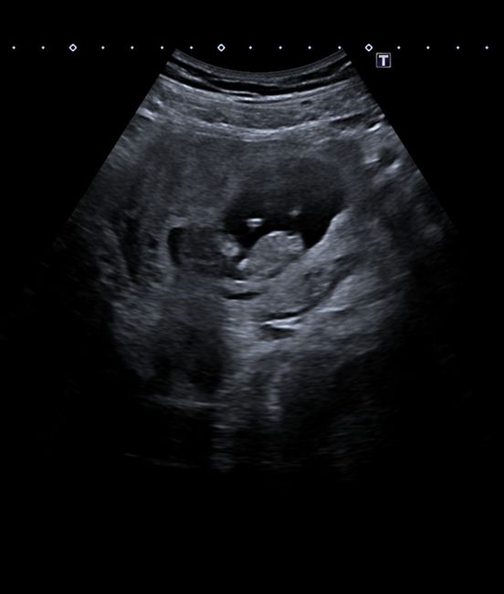 Futuras mamas Diciembre 2020 - 1