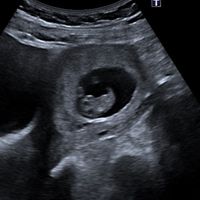 Futuras Mamis Enero 2021 - 1
