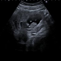 Futuras mamas Diciembre 2020 - 1