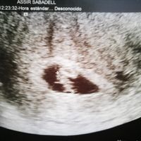 Soy 'Manchita', jaja. 