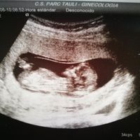 Semana 12