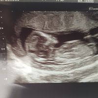 12 semanas... Niño o niña? - 1