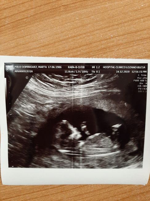 Futuras mamis junio 2021 🤰🏻❤️ oficial - 1