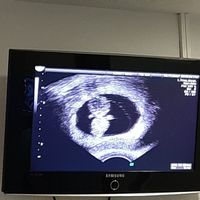 Futuras mamis junio 2021 🤰🏻❤️ oficial - 2