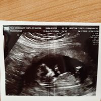 Futuras mamis junio 2021 🤰🏻❤️ oficial - 1