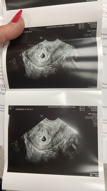 Futuras mamis noviembre 2022 - 1