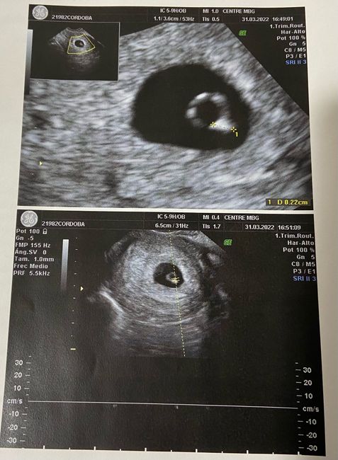 Futuras mamis noviembre 2022 - 1