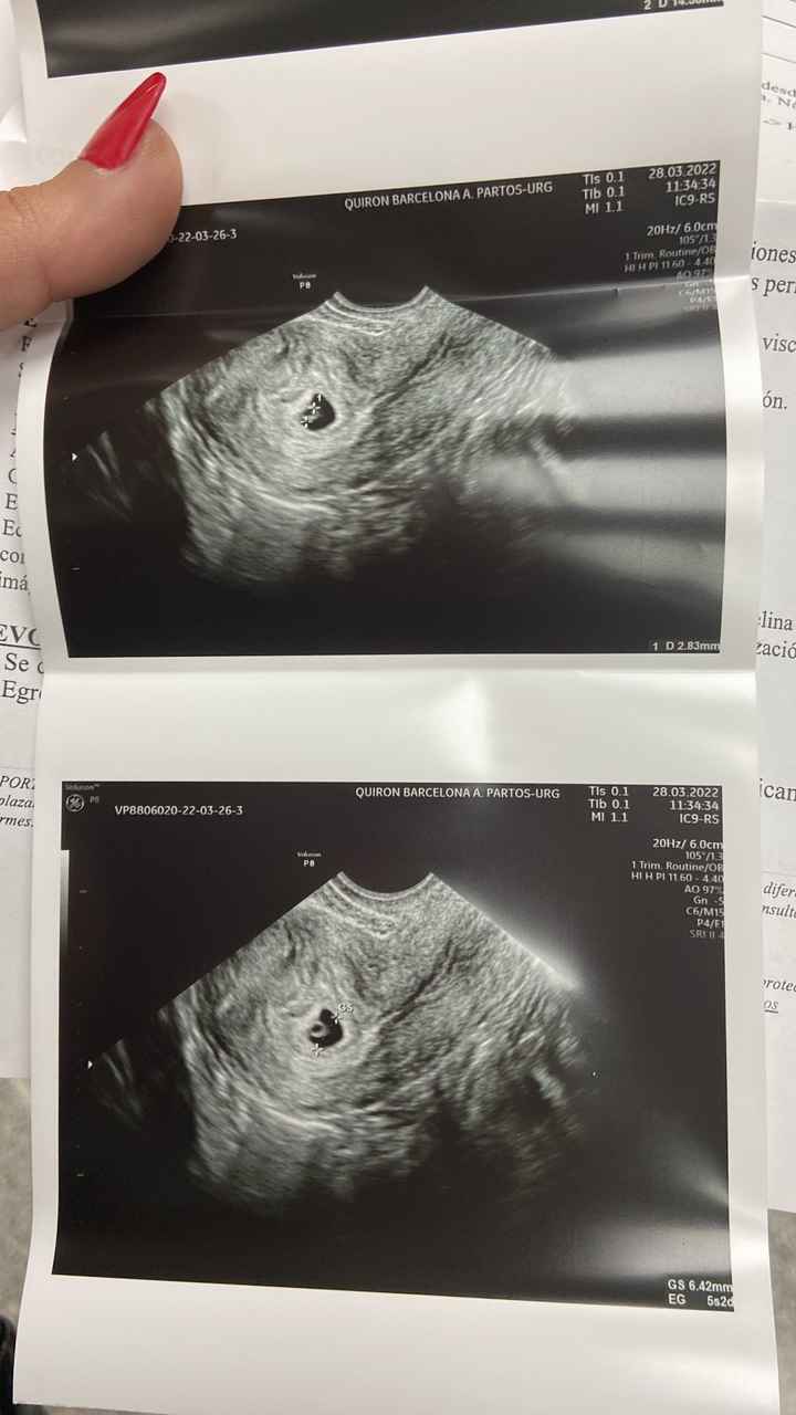 Futuras mamis noviembre 2022 - 1