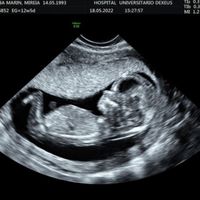 Buscadoras más de 1 año - 2022 - 2