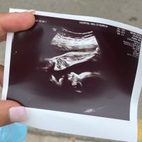 Futuras mamis noviembre 2022 - 1