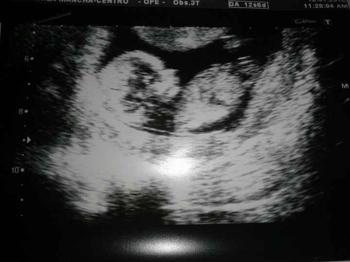 Super mamás julio 2015!! :) - 1
