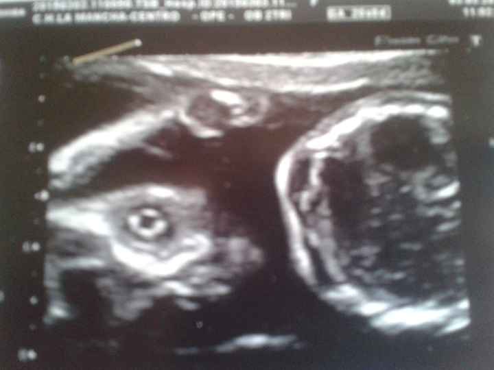 Super mamás julio 2015!! :) - 1