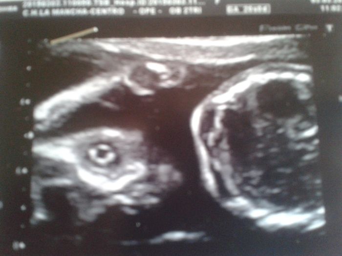 Super mamás julio 2015!! :) - 1