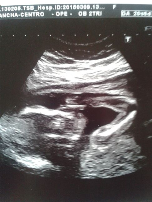 Super mamás julio 2015!! :) - 1