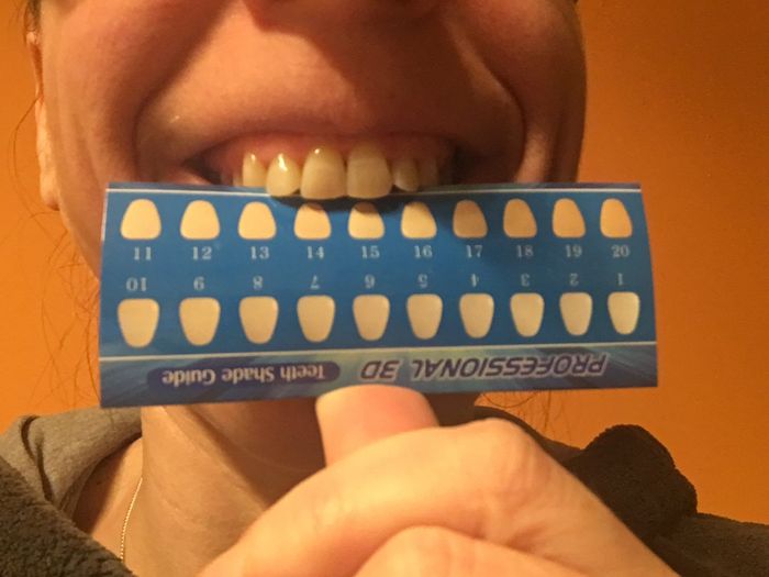  Blanqueo dental 2.0 con tiras - 2