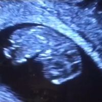 Futuras mamás Octubre 2018!!! - 1