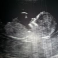 El consultorio de Lita para futuras mamis - 1
