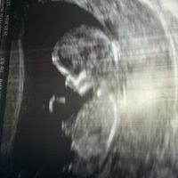 El consultorio de Lita para futuras mamis - 1