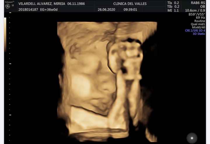 Futuras Mamas Julio 2020. - 1