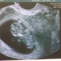 10 SEMANAS+5 DIAS