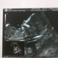 13SEMANAS 5 DIAS