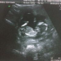13 SEMANAS +5 DIAS
