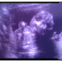 17 semanas y 5 dias