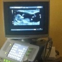 Futuras mamás Diciembre 2018 - 1