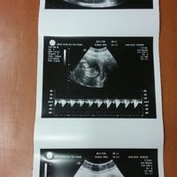 14 semanas eco