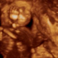 18 semanas ECOX4D
