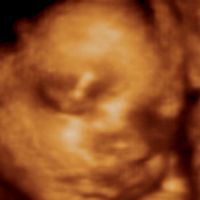 25 SEMANAS ECOX4D